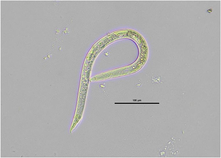 Figure 1: A male root-eating nematode of the Pratylenchus species, collected from carrot roots